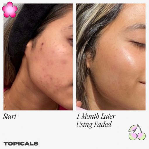 Topicals Faded Serum for Dark Spots & Discoloration - 50 ml