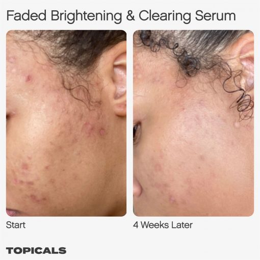 Topicals – Faded Serum for Dark Spots & Discoloration – 15 ml