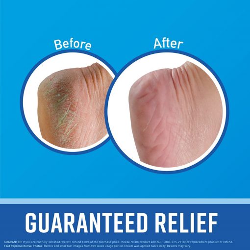 O'Keeffe's - for Healthy Feet Foot Cream, Guaranteed Relief